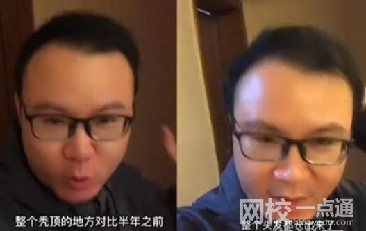 男子回应“不用洗发水变满头黑发” 具体是什么情况?
