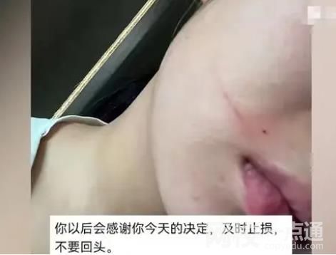 女子怀孕近7个月被丈夫施暴 女子表示不原谅会将小孩引产