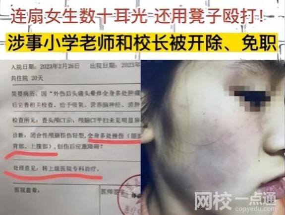 连扇学生数十耳光涉事老师被拘 背后真相实在让人惊愕