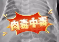 52天婴儿喝奶奶喂的蜂蜜水中毒进ICU 究竟是怎么回事？