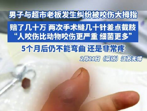 男子因纠纷被超市老板咬伤险截肢 背后真相实在让人惊愕