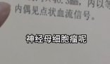 女孩因个矮去体检发现肾上长肿瘤 这也太恐怖了