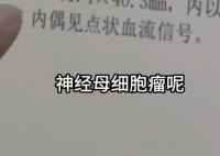 女孩因个矮去体检发现肾上长肿瘤 这也太恐怖了