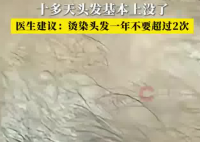 男子一月染头4次致头发大量脱落 实在太无奈了