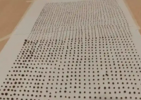 64岁大爷体内取出1791颗结石 这也太恐怖了