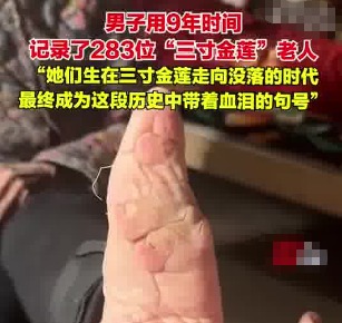 男子用9年时间记录了283位裹脚老人 为什么引争议？