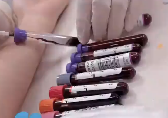 医生:胖人比瘦人更能抗病 到底是不是真的？