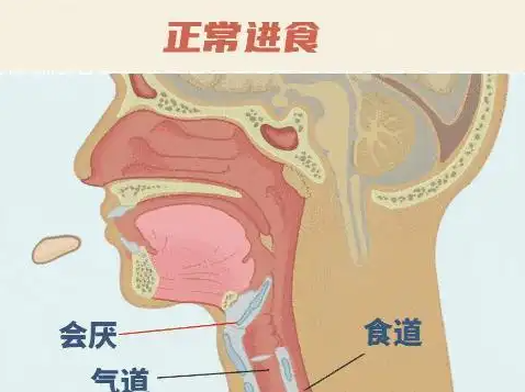 26岁女孩突发会厌炎仅10分钟去世 实在太可怕了