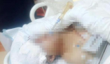 贵州一男子被野猪咬成重伤 究竟是怎么回事？