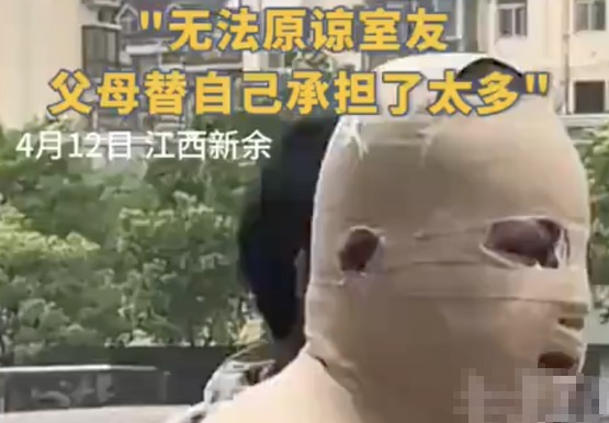 全身90%烧伤男生说父母借钱太心酸 究竟是怎么回事？