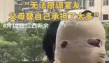 全身90%烧伤男生说父母借钱太心酸 究竟是怎么回事？