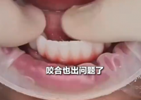 女子花6万植12颗牙2年调试20多次 究竟是怎么回事？