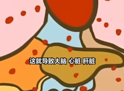 医生:患热射病时内脏像被开水煮 这也太危险了