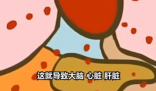 医生:患热射病时内脏像被开水煮 到底是什么情况？