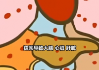 医生:患热射病时内脏像被开水煮 到底是什么情况？