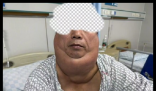 男子每天1斤酒喝出