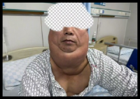 男子每天1斤酒喝出