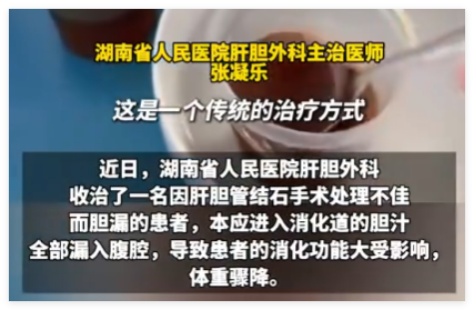 男子每天喝500ml自己的胆汁救命 真相简直太意外了