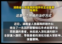 男子每天喝500ml自己的胆汁救命 真相简直太意外了