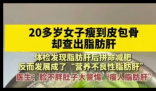 20岁女子瘦到皮包骨查出脂肪肝 内幕曝光简直太意外了