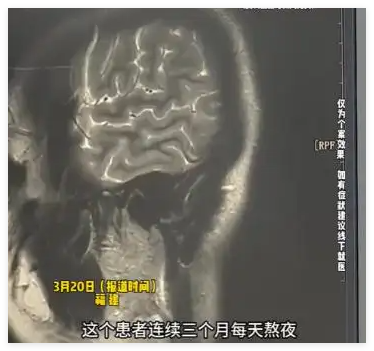 女子熬夜3个月突然开始对墙讲课 究竟是怎么回事?