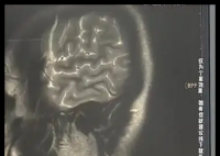 女子熬夜3个月突然开始对墙讲课 内幕曝光简直太意外了