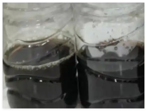 8岁男孩发烧10天尿出酱油色 究竟是怎么回事？