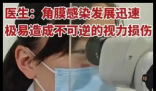 男子戴隐形眼镜过夜致左眼失明 究竟是怎么回事？
