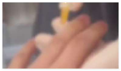 医生回应男子往手指打玻尿酸 背后真相实在让人惊愕