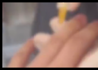 医生回应男子往手指打玻尿酸 内幕曝光简直太意外了
