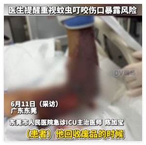 广东阿叔被不明蚊虫咬到险截肢 内幕曝光简直太意外了