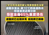 2岁女孩洗澡被70度热水淋烫2分钟 医生提醒：婴幼儿洗澡全程应有专人看护
