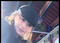 宠物博主感染罕见真菌病逝 年仅27岁 简直太悲剧了